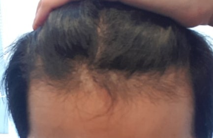 12 months have passed by MoPlus. Satisfied