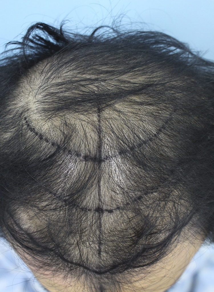 photo_1510298601.png