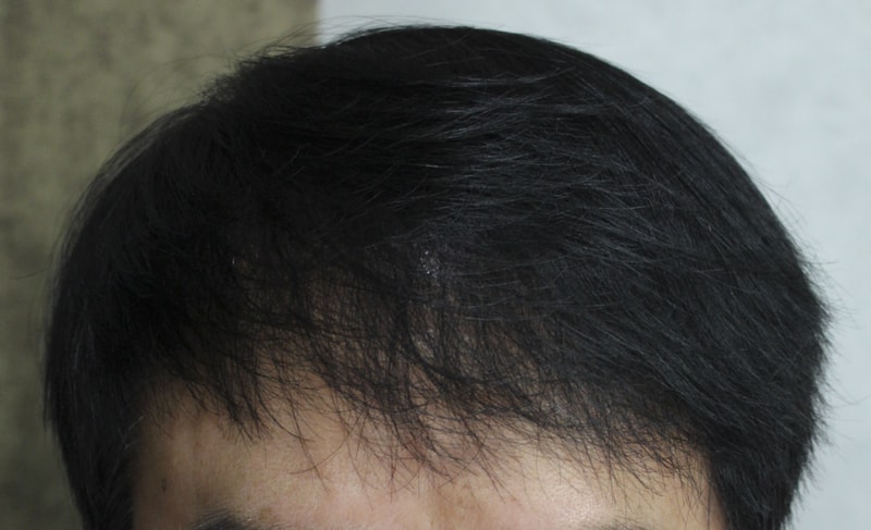 003.jpg
