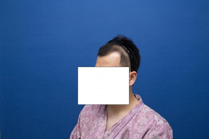 수술전좌측-크기조정.jpg