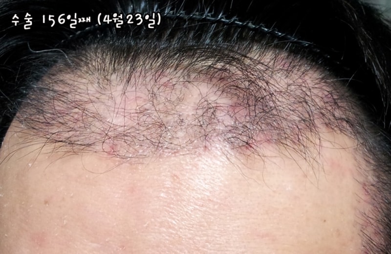 4월23일(156일째)s.jpg
