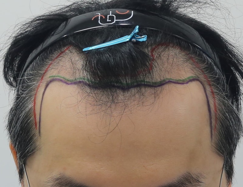 1000007357.jpg