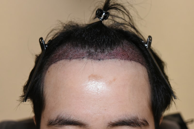 샴푸 후 정면.jpg