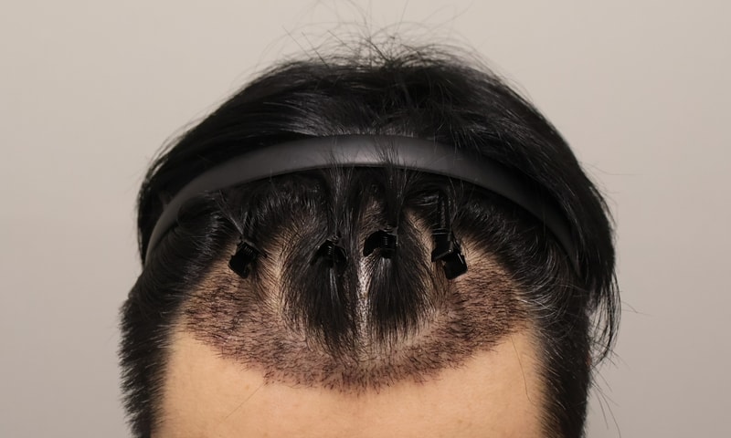 1000005011.jpg