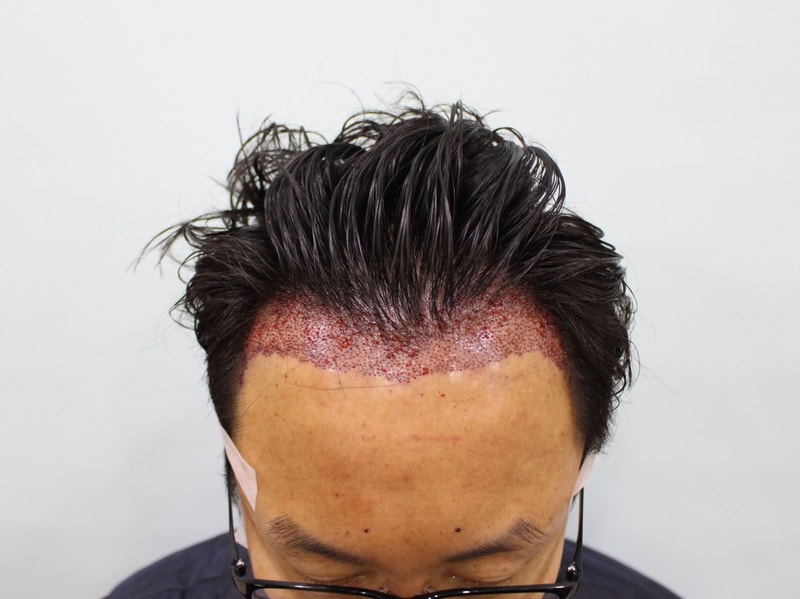 수술후.jpg