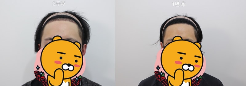 리즈모2.jpg