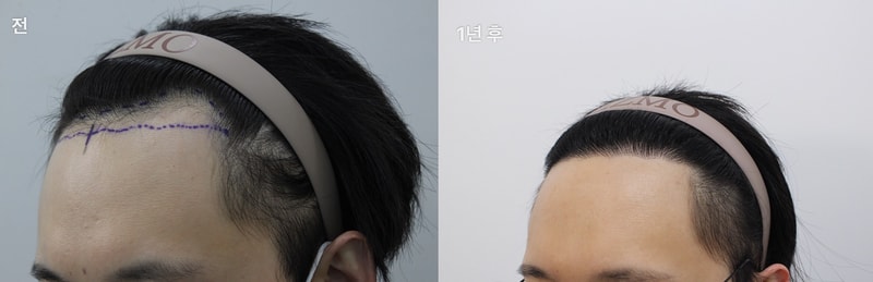 리즈모3.jpg