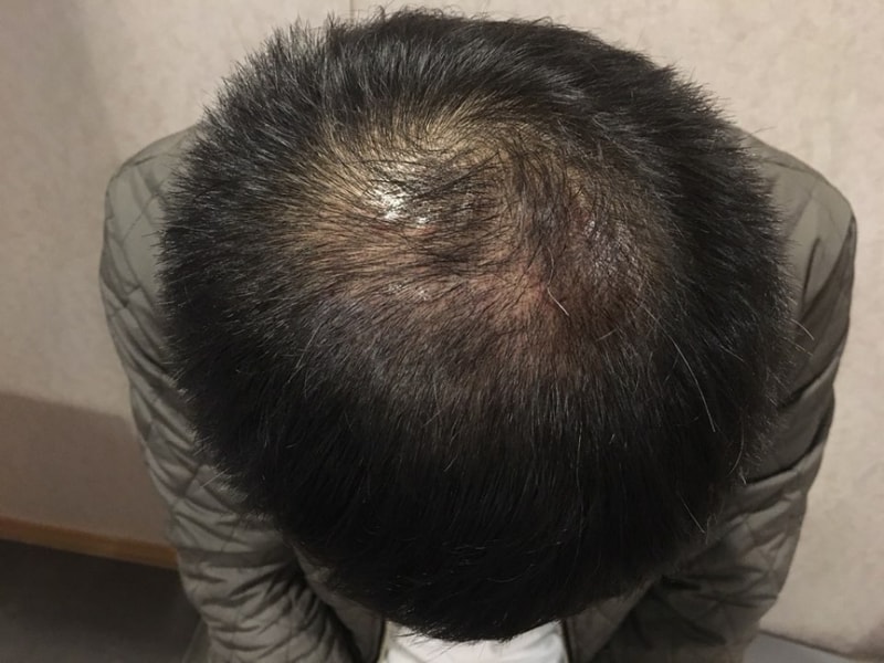 KakaoTalk_20180614_151014181.jpg