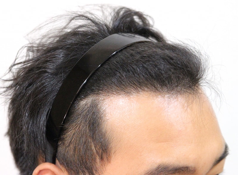 후3.jpg