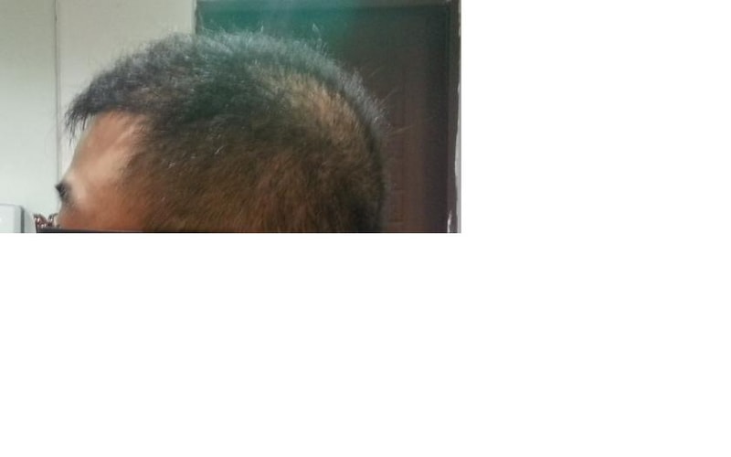 5개월옆.JPG