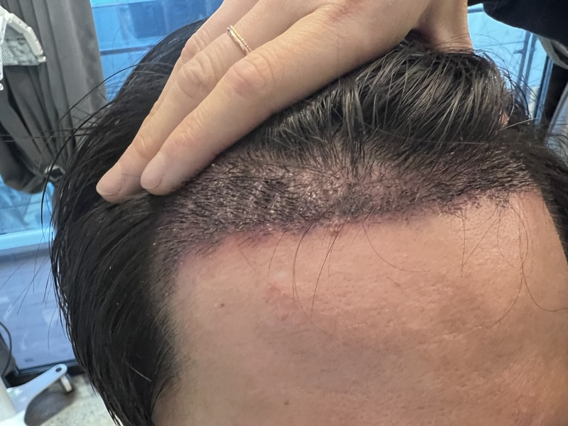 2. 수술후_2주_2.jpg