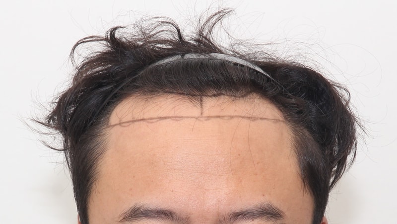 수술전_1.jpg