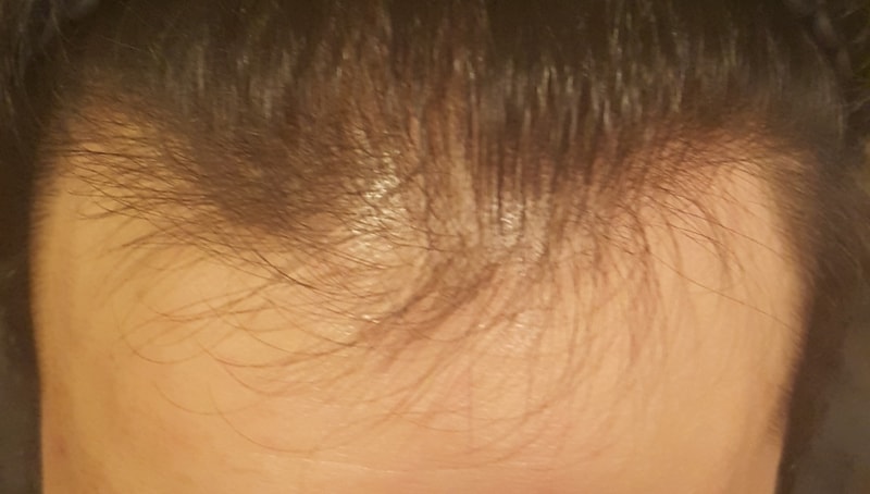 수술전.jpg