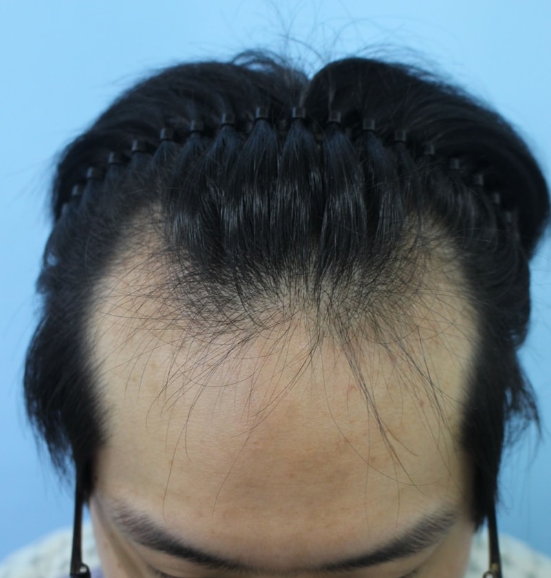 hair_01.jpg