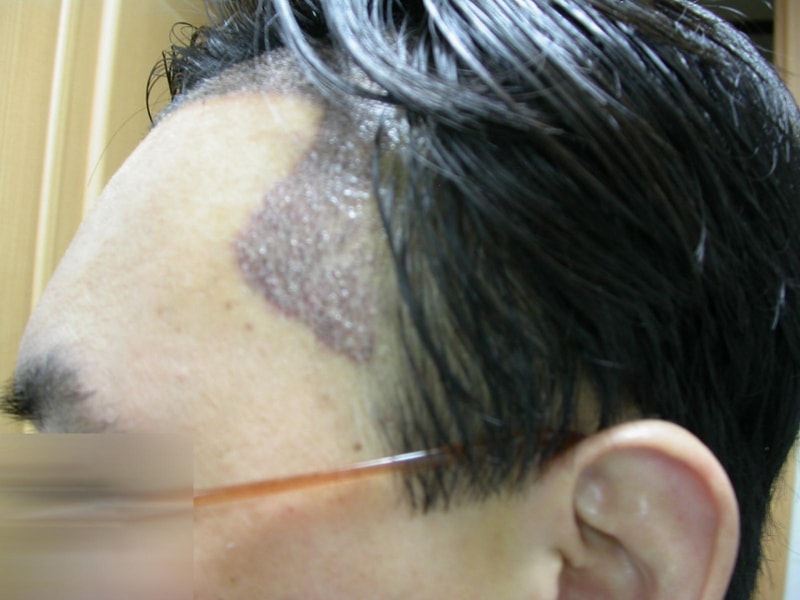 수술후3.jpg