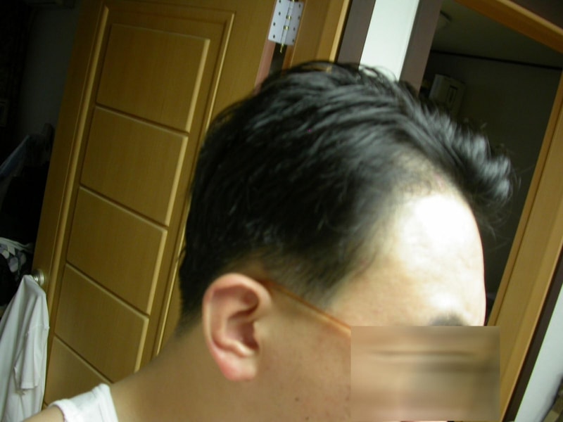 수술전2.jpg