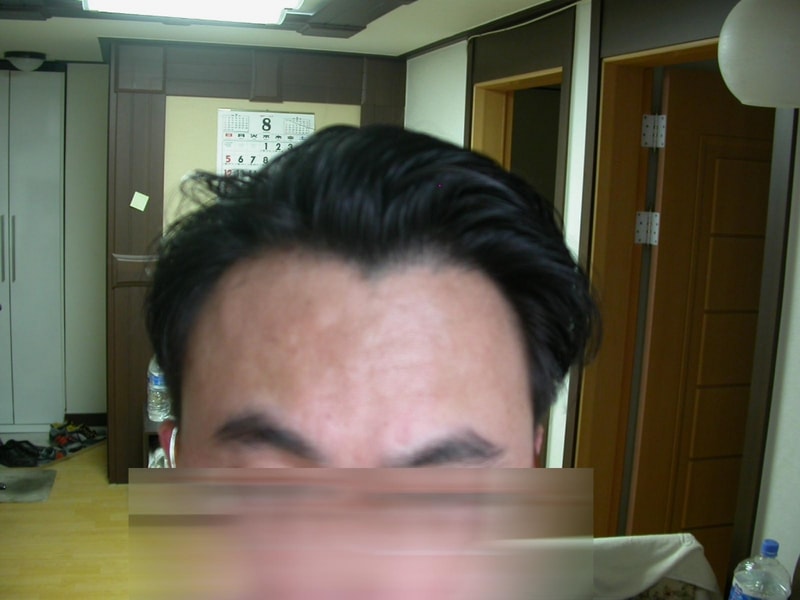 수술전1.jpg