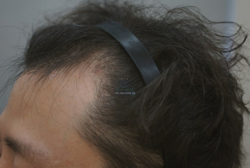 フォーヘアソウル1500モナン、10ヵ月目を上げます