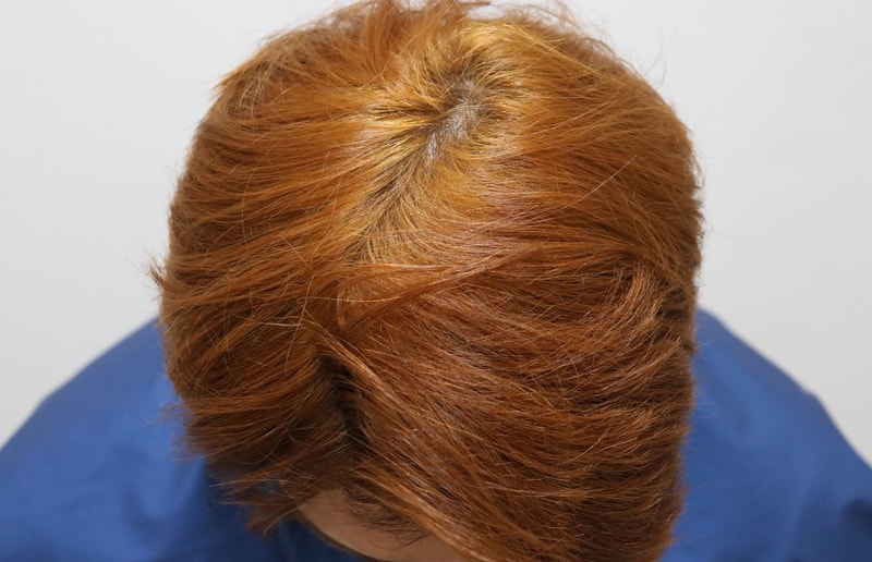 I also dyed my hair that I wanted to do for 6 months^^