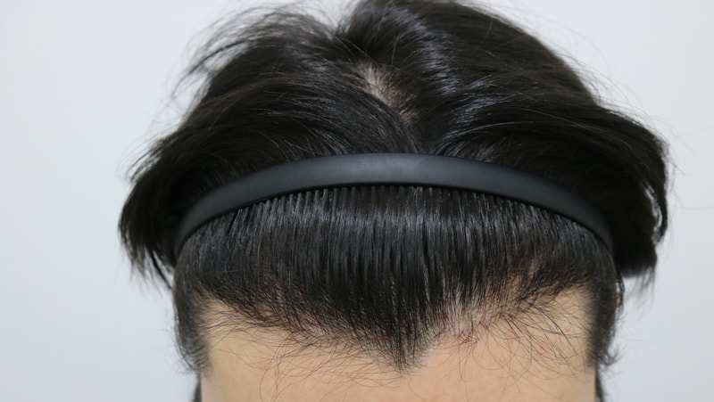 MOST是9个月后期