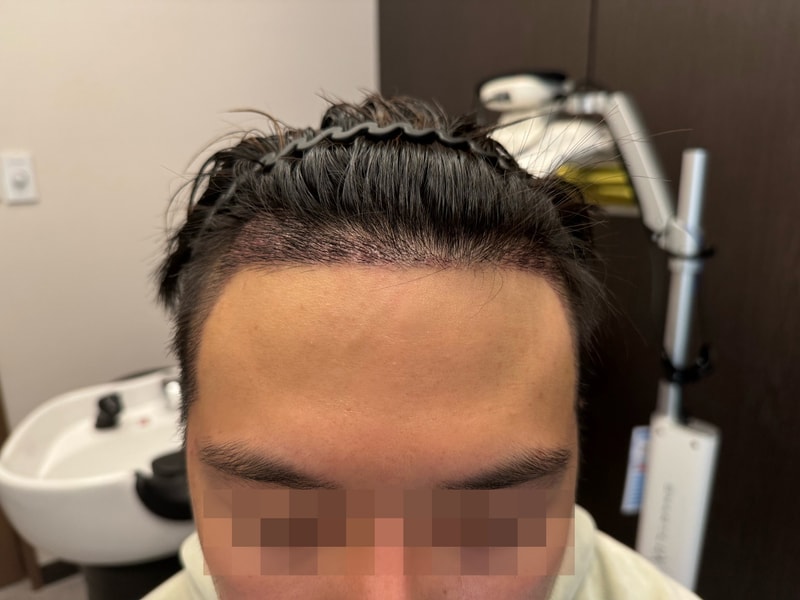 후3.jpg