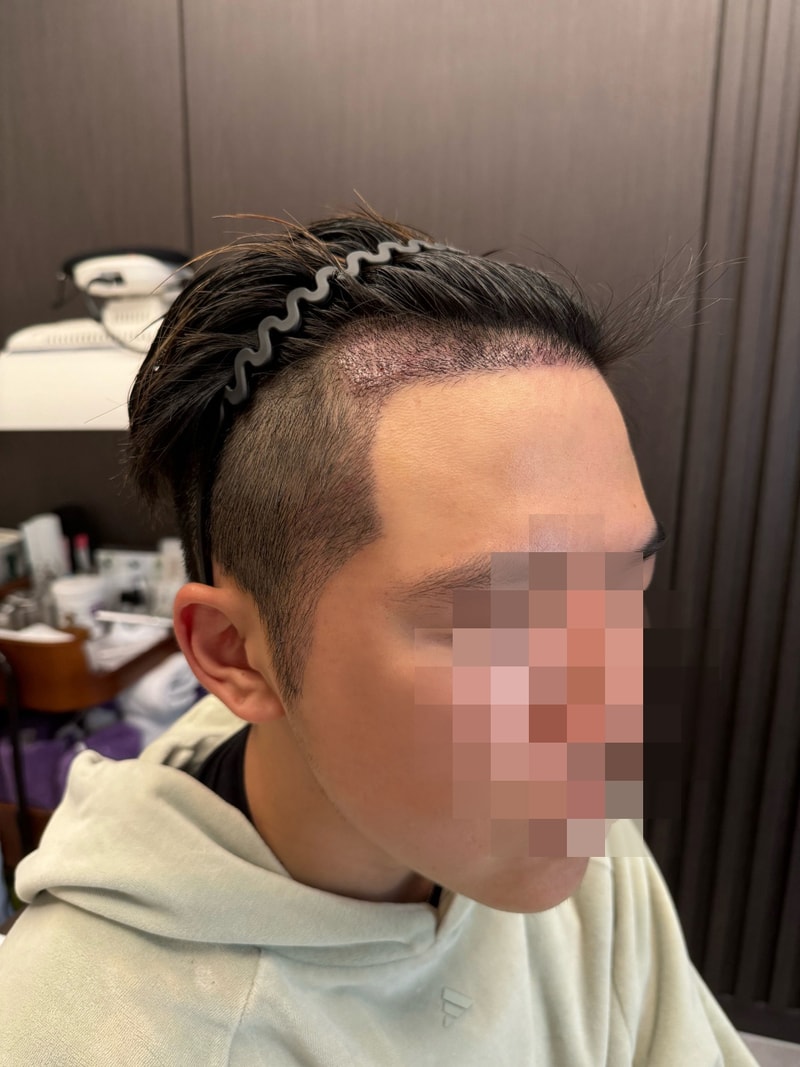 후2.jpg