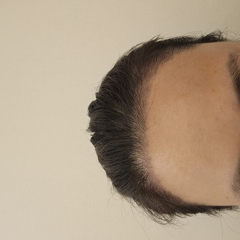 후1.jpg