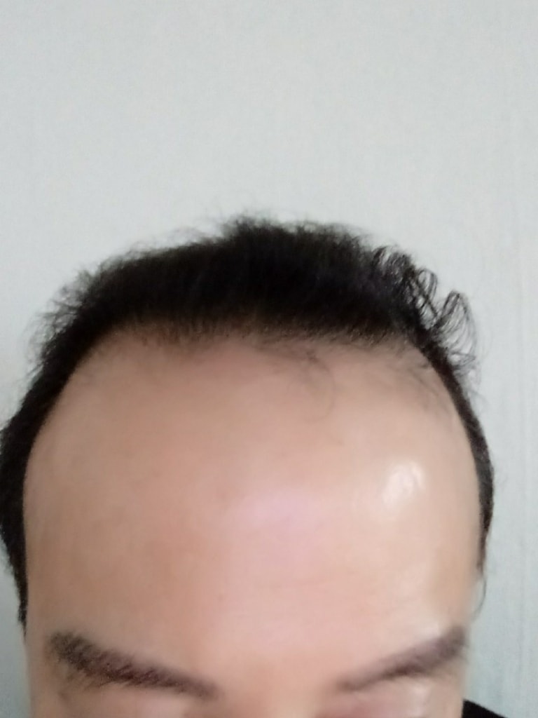 3870모 3개월 포토후기 올려봅니다