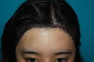 수술후1.jpg