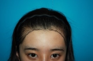 수술전1.jpg