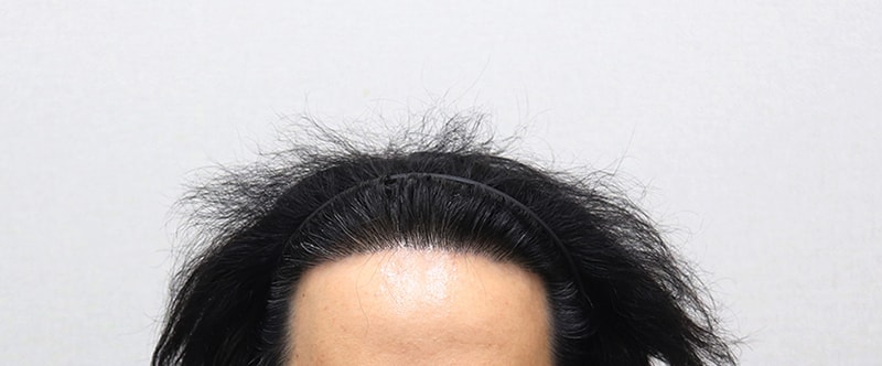 1년 경과.jpg