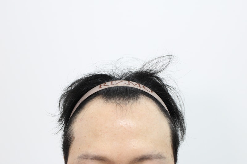 포토후기 이미지