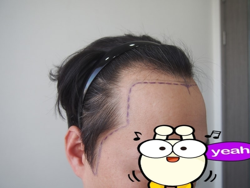 Evaluation and review of photos immediately after surgery