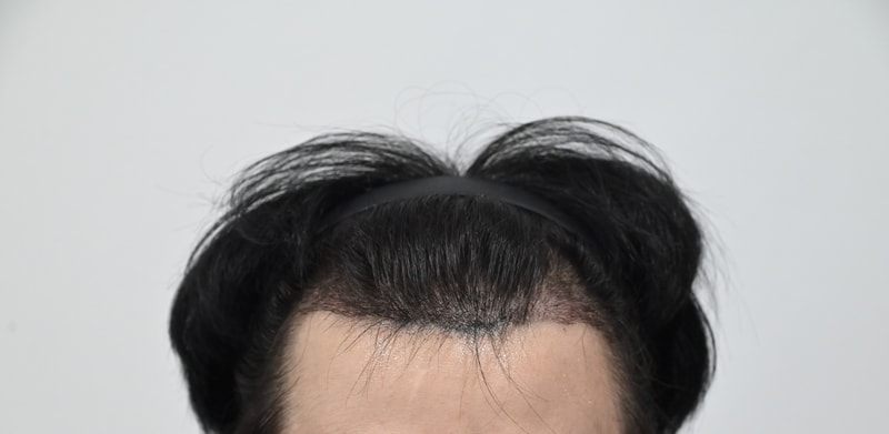 앞후.jpg