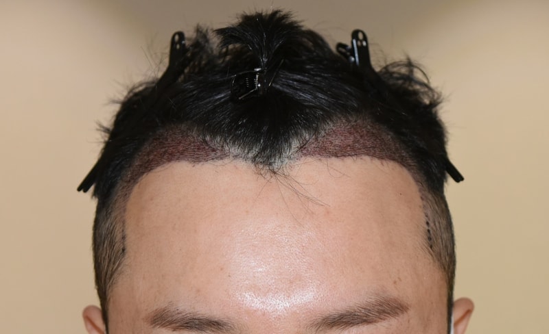 샴푸후2.jpg