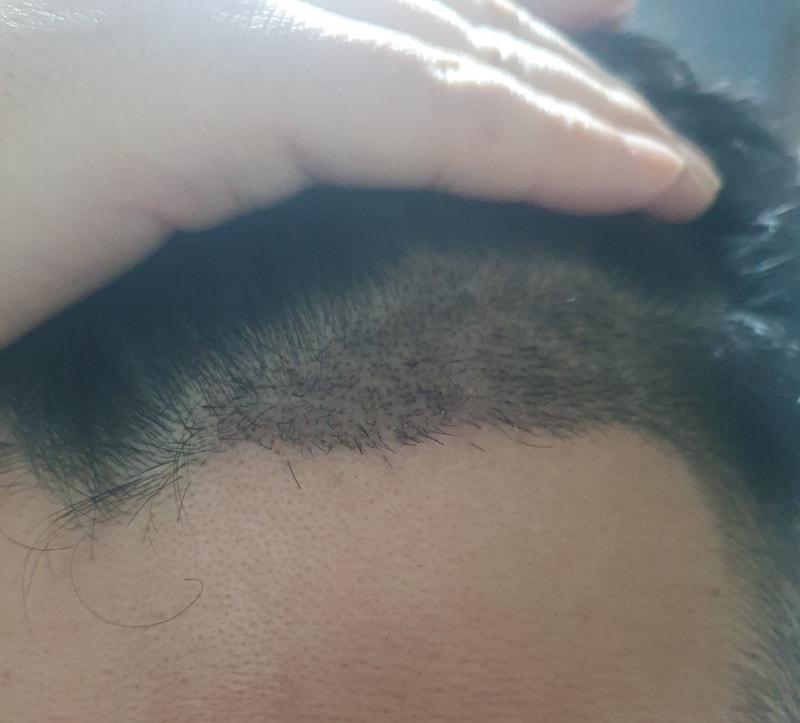 10일 경과2.jpg