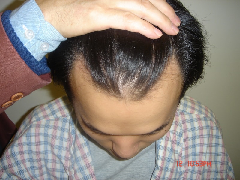 수술전2.JPG