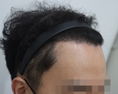 5 12개월 2.jpg