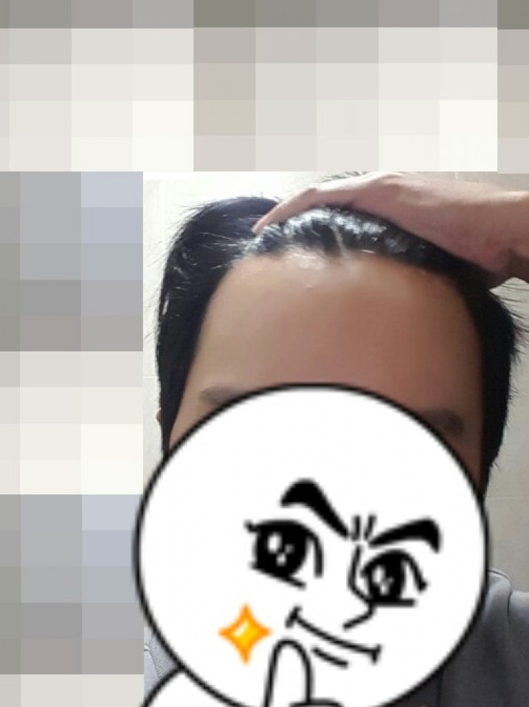 大邱FORHAIR经过211天