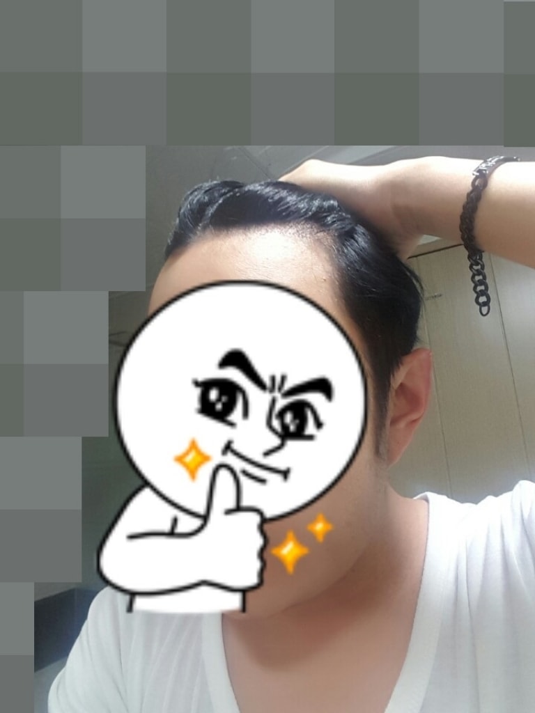大邱FORHAIR经过244天