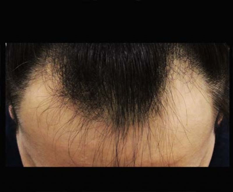 before.jpg