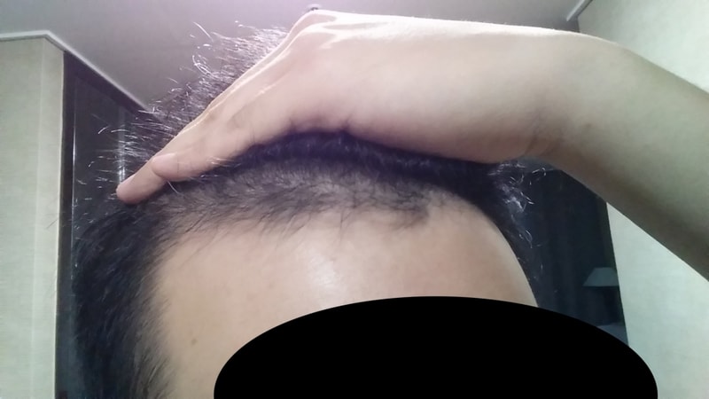4개월2.jpg