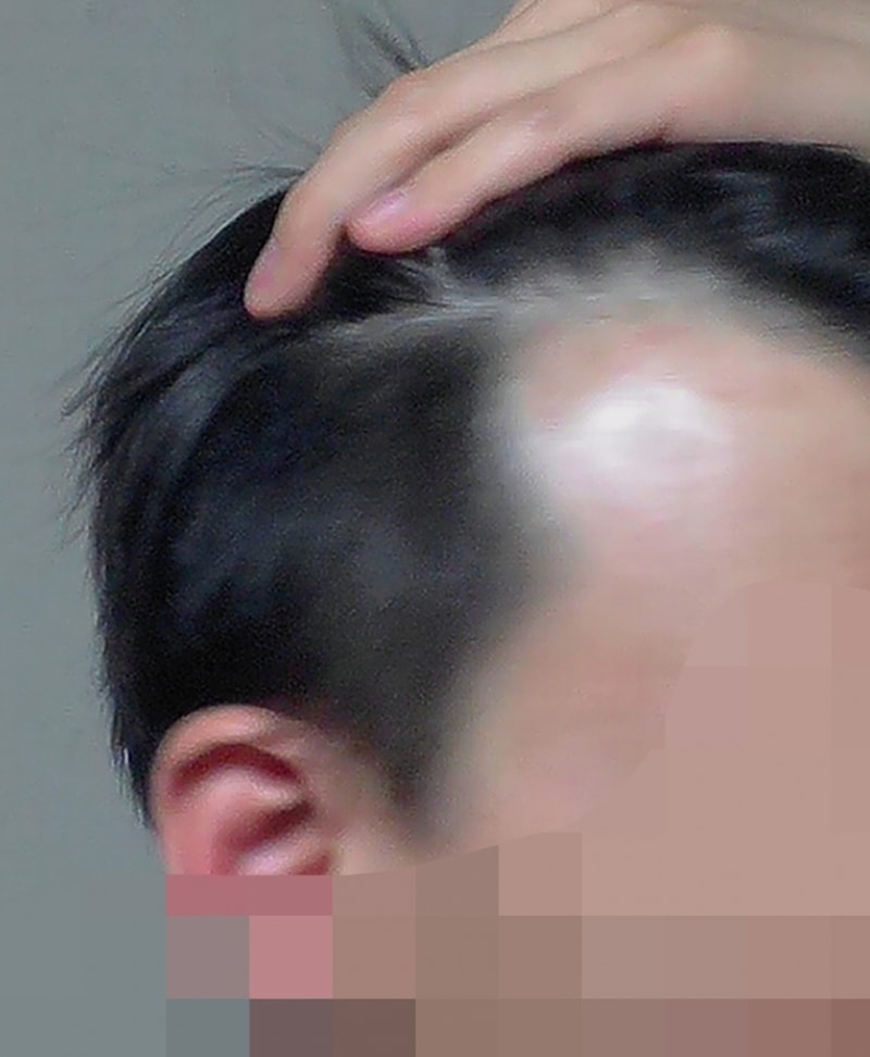 0304_전날_측면.jpg