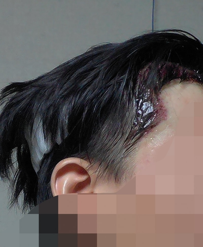0305_당일날_측면.jpg