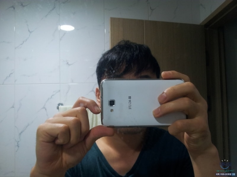 2014년(2차이식전.2).jpg