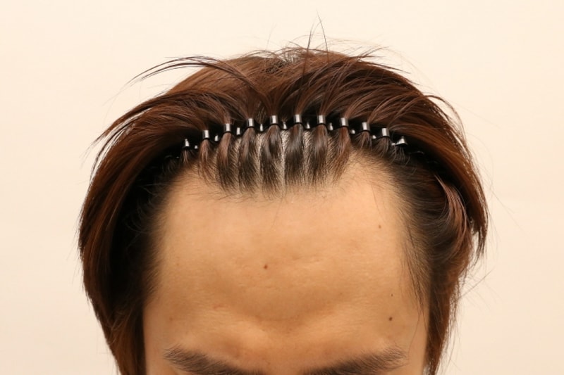 ewrfer.JPG