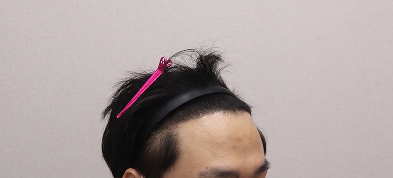 6개월 경과.JPG