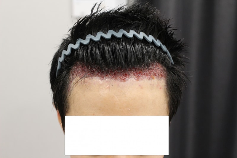 수술당일.jpg