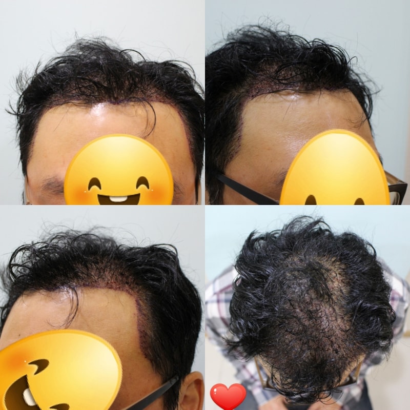 샴프후.jpg