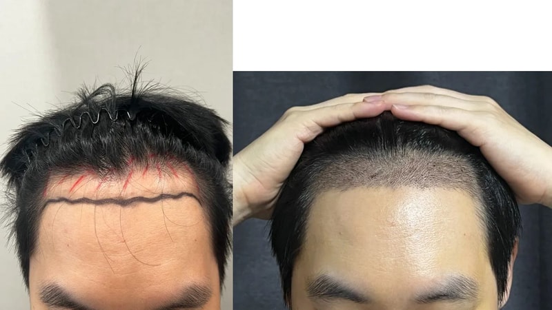 포토후기 이미지